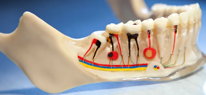 Root canal treatment at South Dental